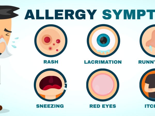 Allergy